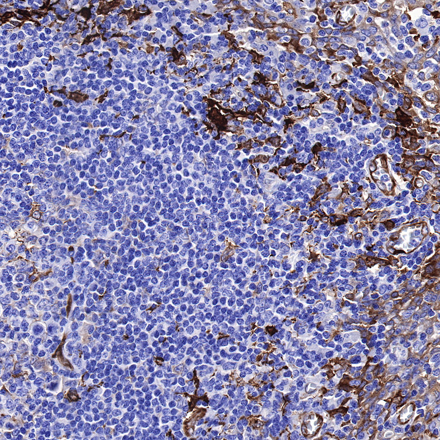Rabbit anti-Fascin Recombinant Monoclonal Antibody(S-759-13)