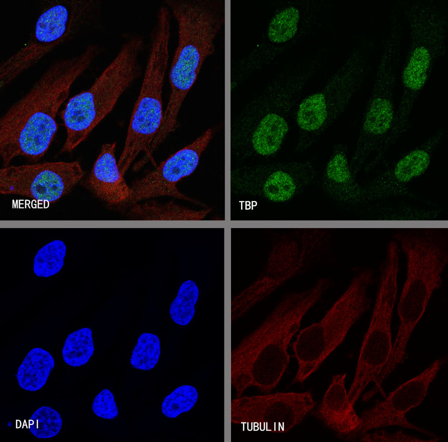 Rabbit anti-TBP Recombinant Monoclonal Antibody(S-886-57)