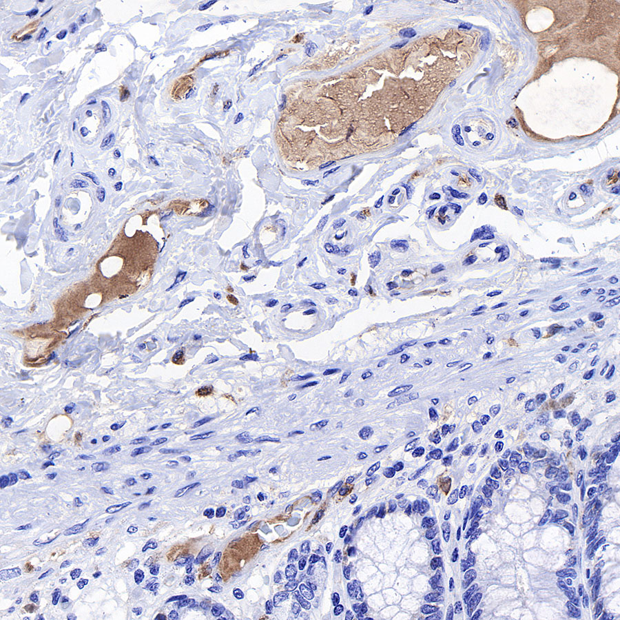 Rabbit anti-C1q Recombinant Monoclonal Antibody(S-472-105)