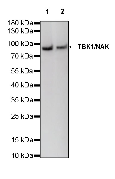 Rabbit anti-TBK1 Recombinant Monoclonal Antibody(S-658-50)
