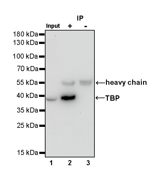 Rabbit anti-TBP Recombinant Monoclonal Antibody(S-886-57)