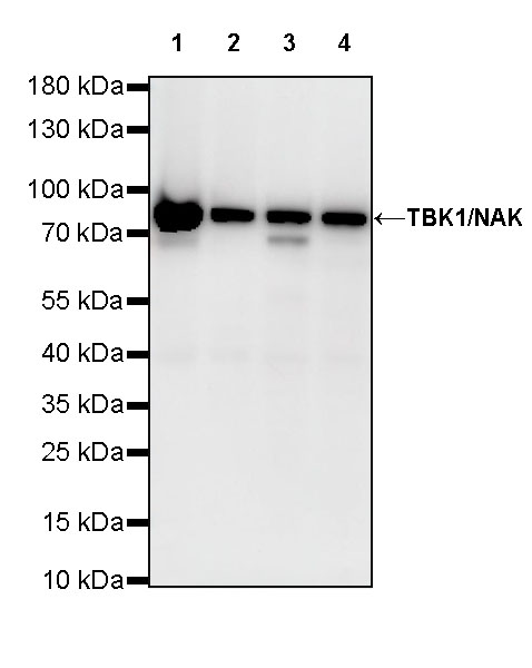 Rabbit anti-TBK1 Recombinant Monoclonal Antibody(S-658-50)