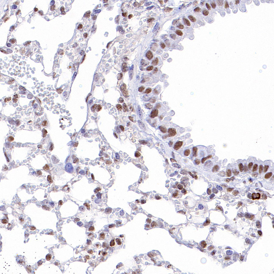 Rabbit anti-p27 Recombinant Monoclonal Antibody(S-141-135)