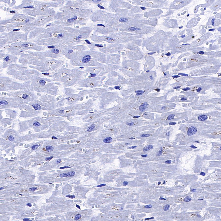 Rabbit anti-Calreticulin Recombinant Monoclonal Antibody(S-R353)