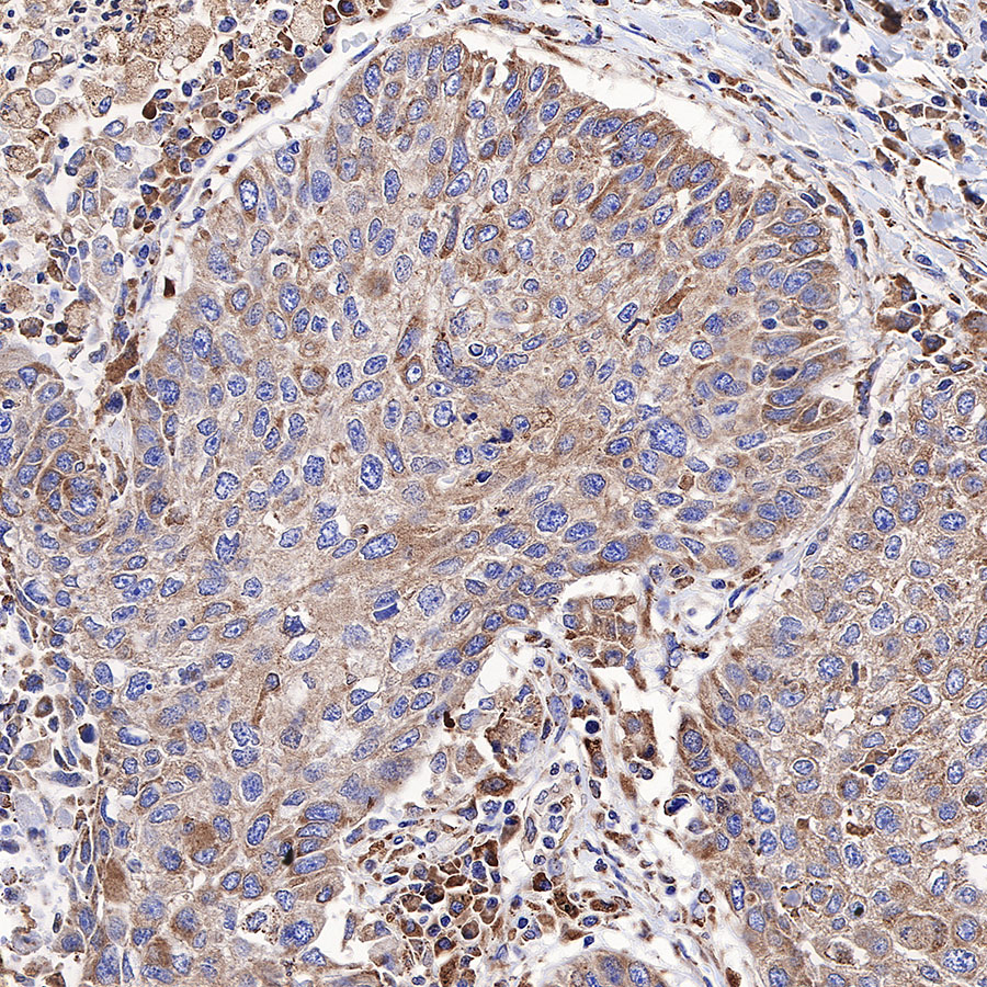 Rabbit anti-Calreticulin Recombinant Monoclonal Antibody(S-R353)