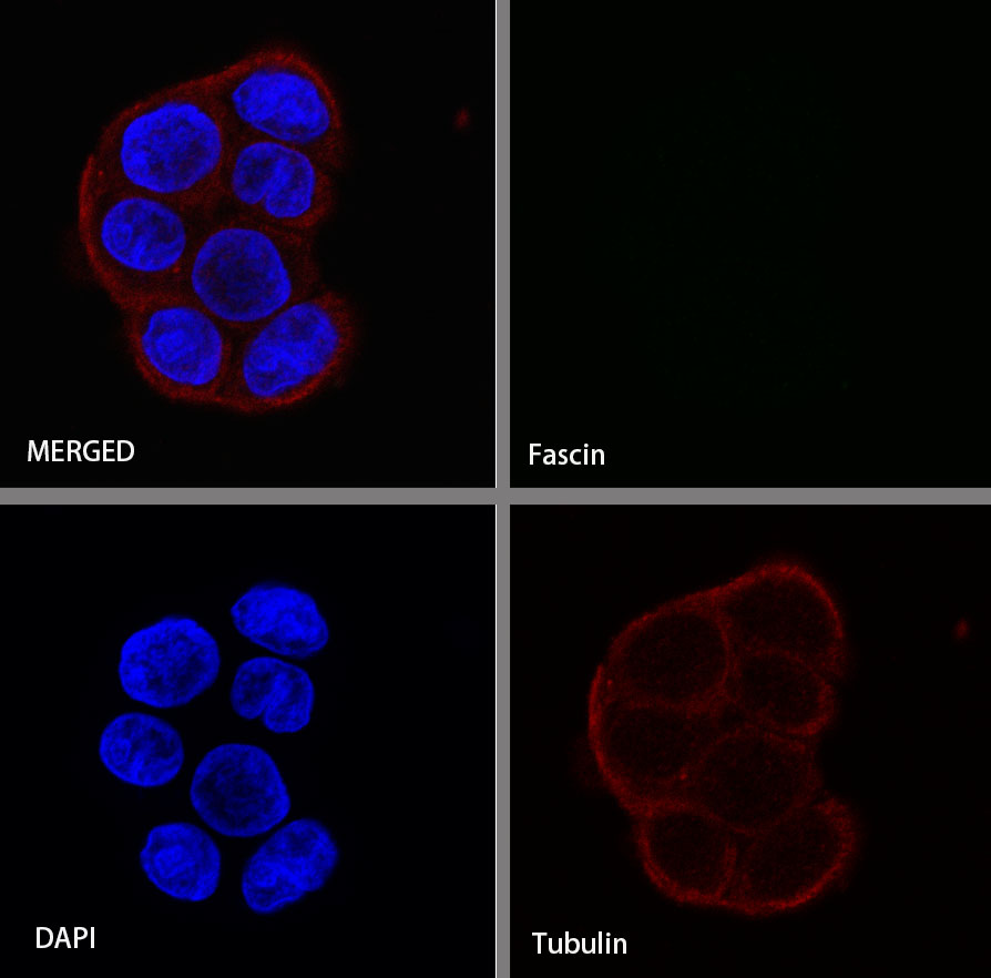 Rabbit anti-Fascin Recombinant Monoclonal Antibody(S-759-13)