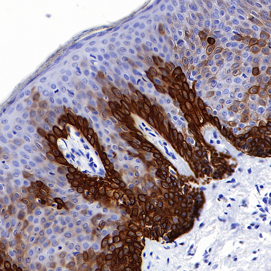 Rabbit anti-Keratin 16 Recombinant Monoclonal Antibody(S-R306)