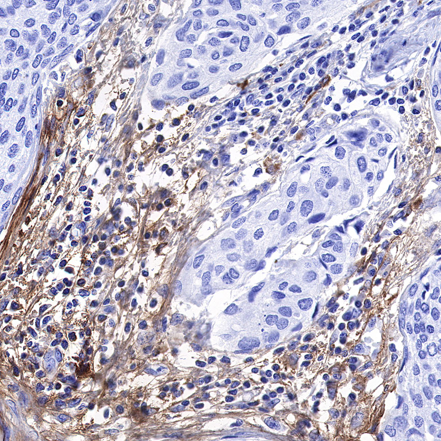 Rabbit anti-C1q Recombinant Monoclonal Antibody(S-472-105)