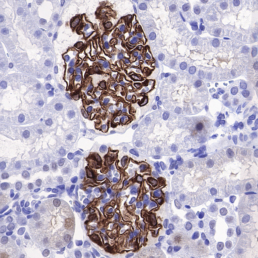 Rabbit anti-Nephrin Recombinant Monoclonal Antibody(S-543-63)