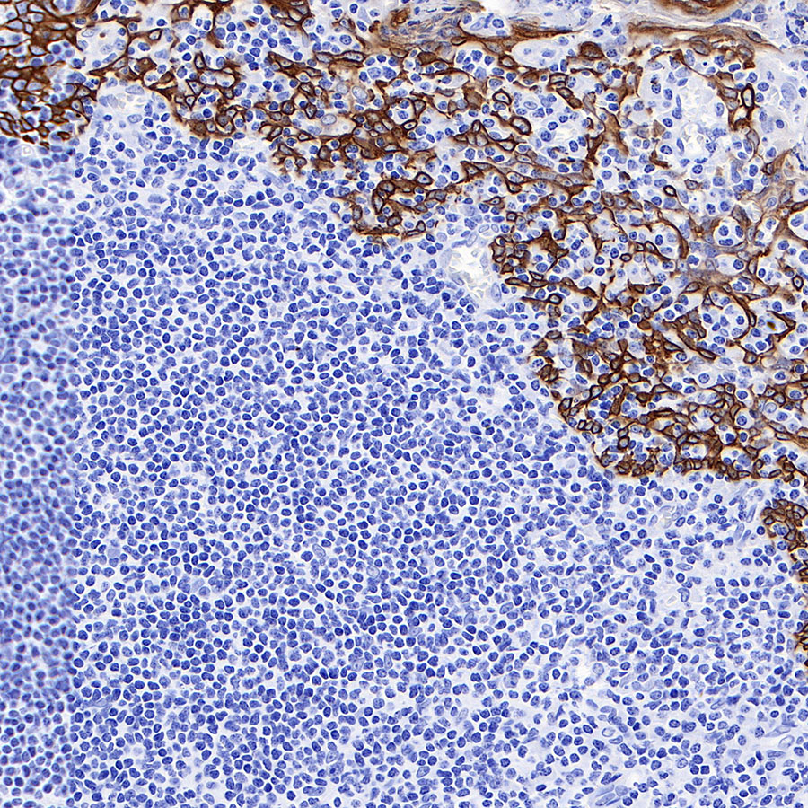 Rabbit anti-Keratin 16 Recombinant Monoclonal Antibody(S-R306)