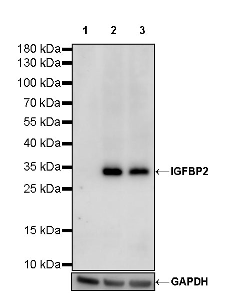 Rabbit anti-IGFBP2 Recombinant Monoclonal Antibody(S-808-24)
