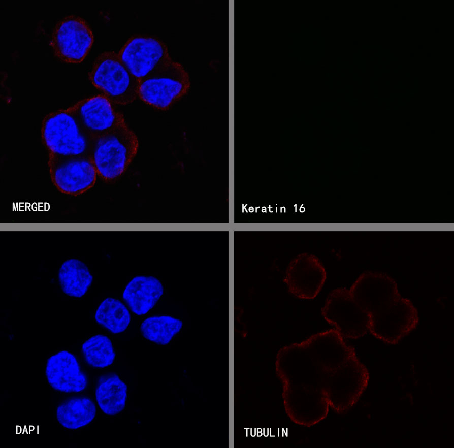 Rabbit anti-Keratin 16 Recombinant Monoclonal Antibody(S-R306)