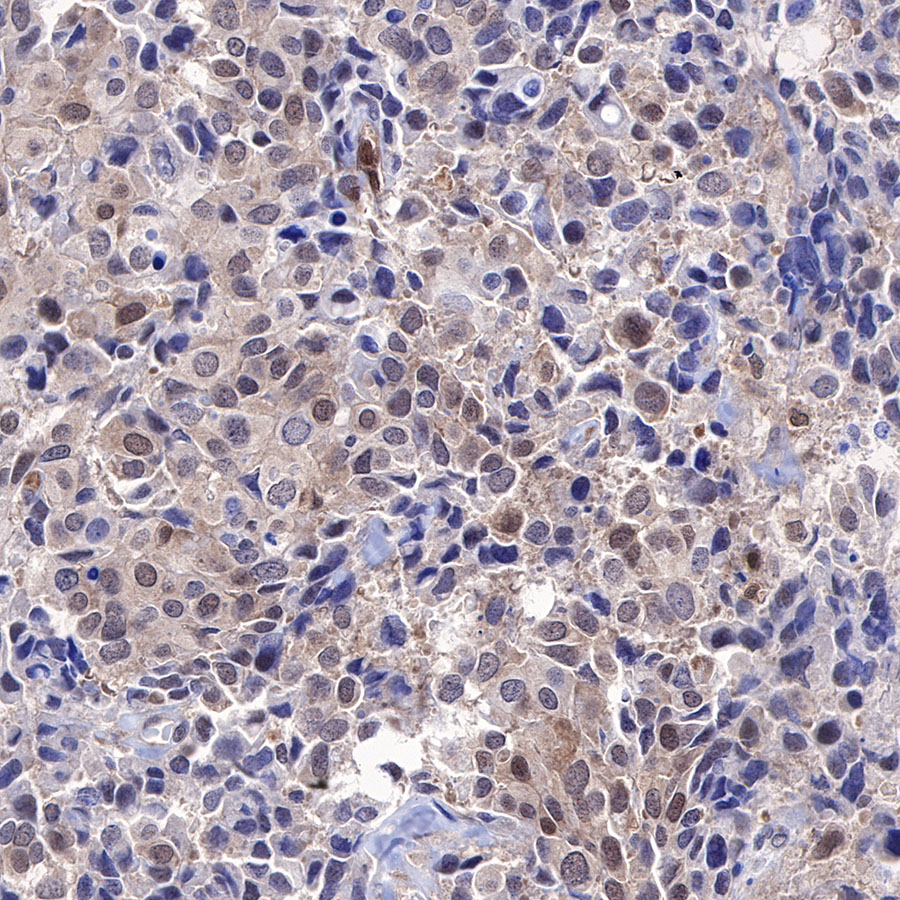 Rabbit anti-MEK3 Recombinant Monoclonal Antibody(S-835-23)