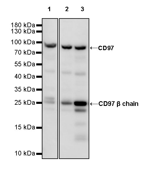 Rabbit anti-CD97 Recombinant Monoclonal Antibody(S-667-80)
