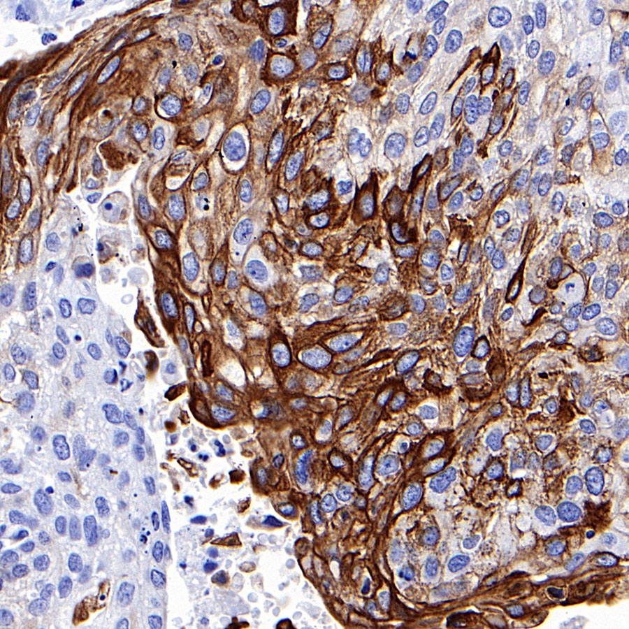 Rabbit anti-Keratin 16 Recombinant Monoclonal Antibody(S-R306)