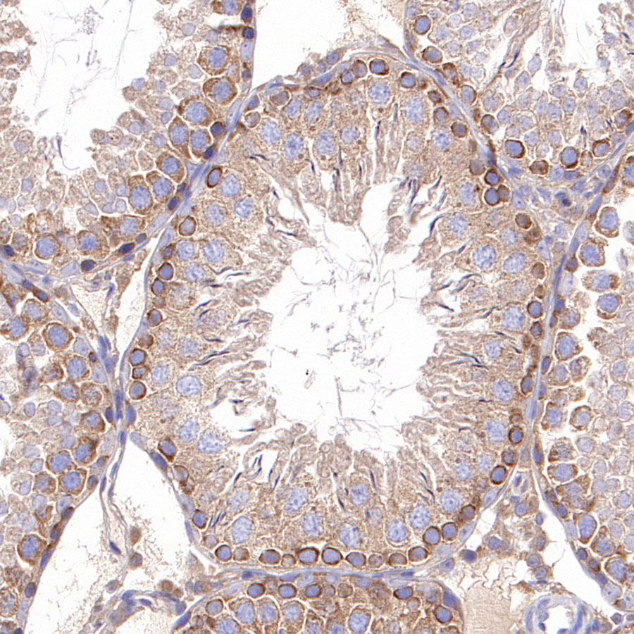 Rabbit anti-TBK1 Recombinant Monoclonal Antibody(S-658-50)