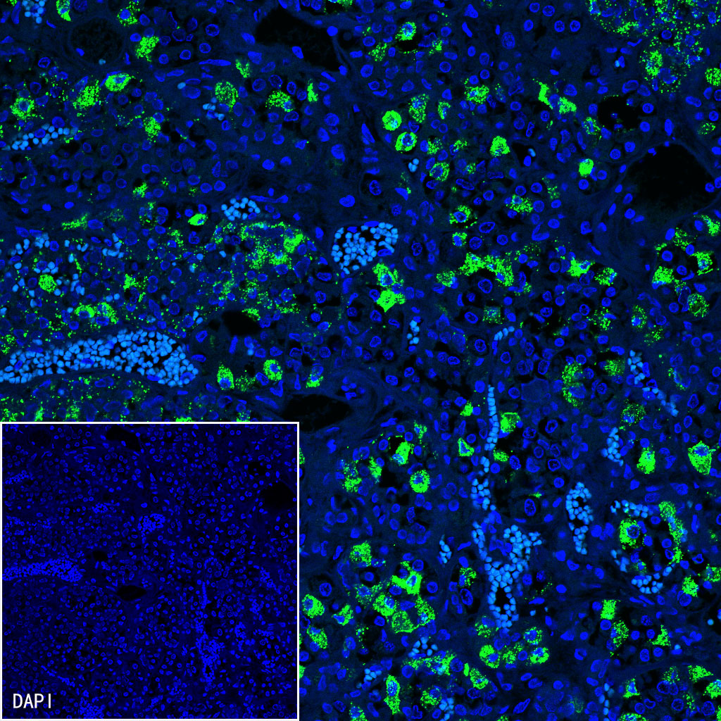 Rabbit anti-Luteinizing Hormone β Recombinant Monoclonal Antibody(545-2)