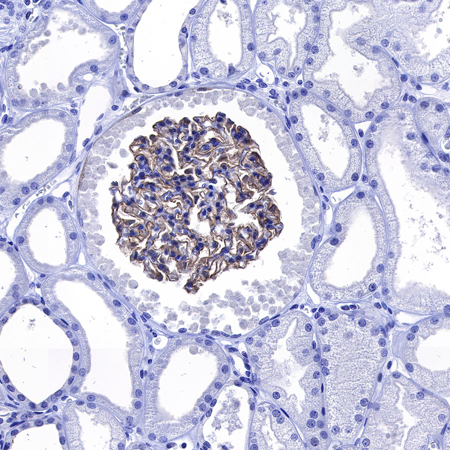 Rabbit anti-Nephrin Recombinant Monoclonal Antibody(S-543-63)
