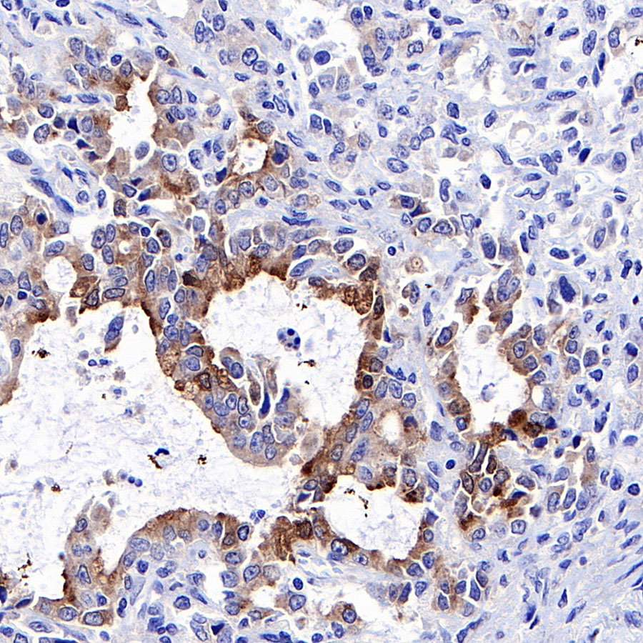 Rabbit anti-IGFBP2 Recombinant Monoclonal Antibody(S-808-24)