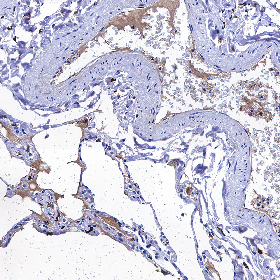 Rabbit anti-C1q Recombinant Monoclonal Antibody(S-472-105)