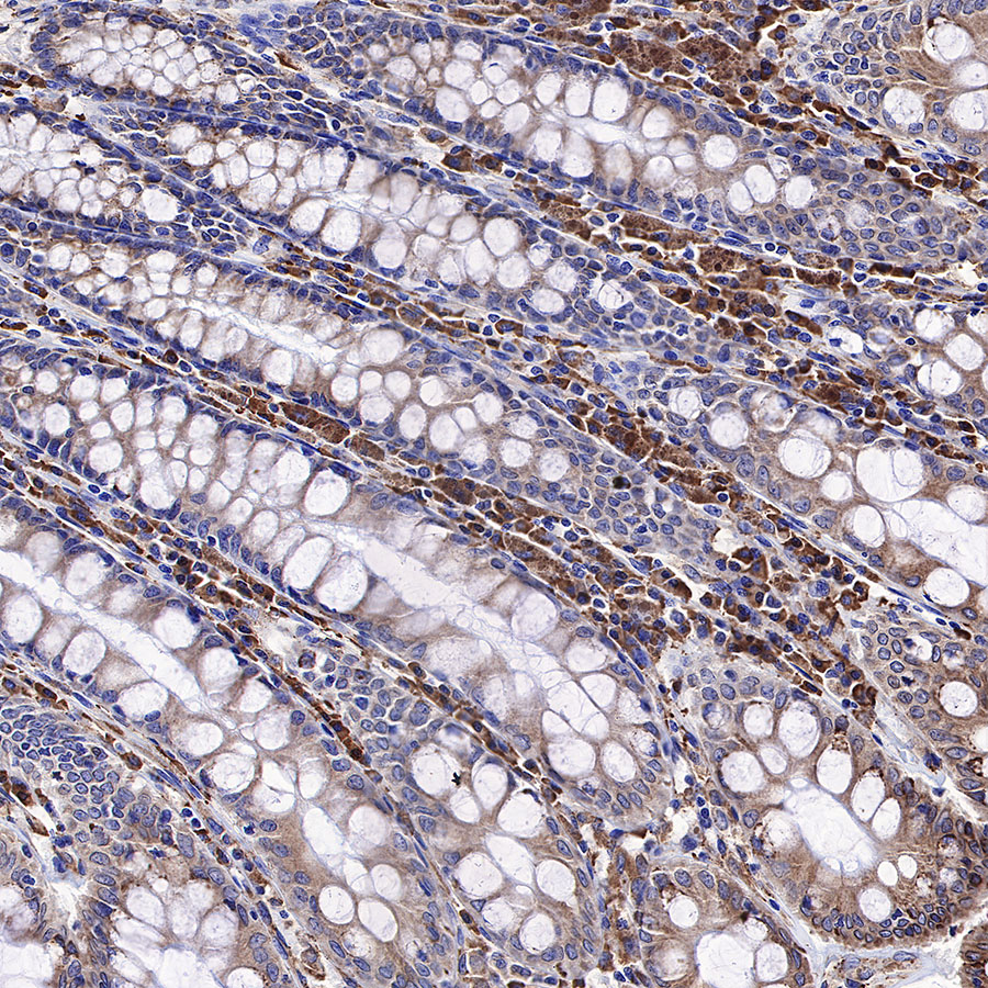 Rabbit anti-Calreticulin Recombinant Monoclonal Antibody(S-R353)