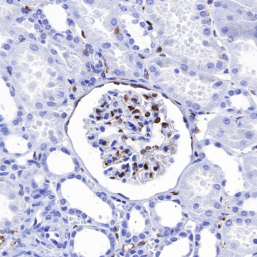 Rabbit anti-Fascin Recombinant Monoclonal Antibody(S-759-13)