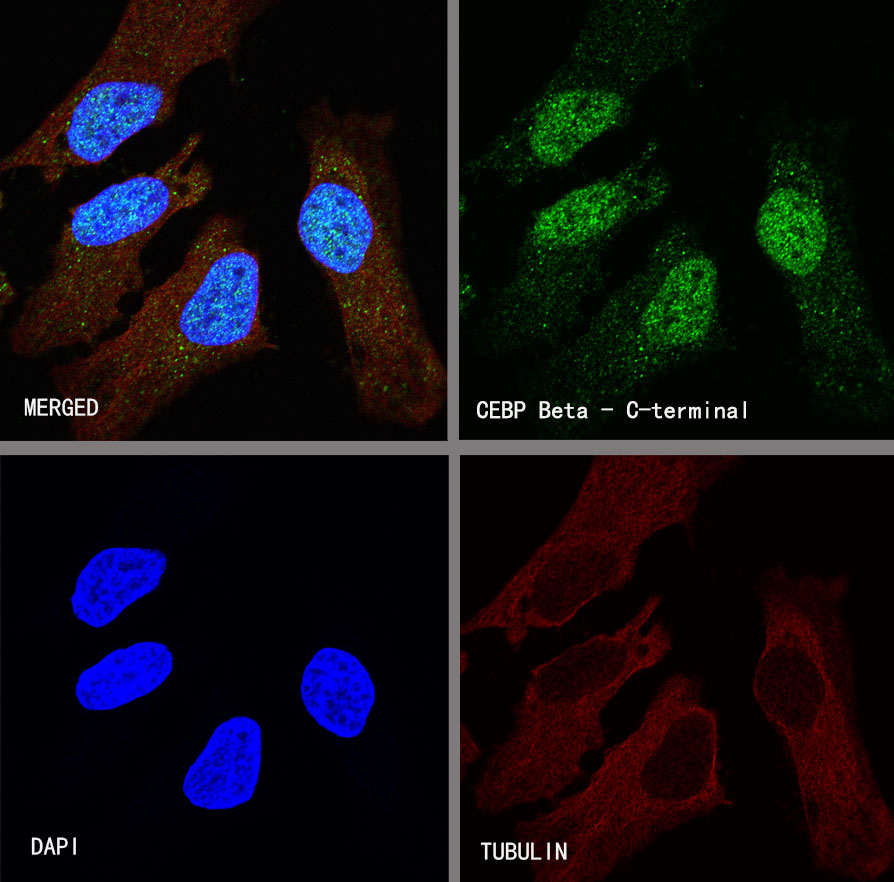 Rabbit anti-CEBP β Recombinant Monoclonal Antibody(C-term)(S-773-48)