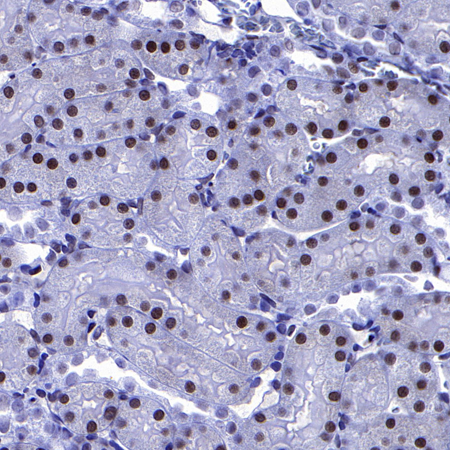 Rabbit anti-p27 Recombinant Monoclonal Antibody(S-141-135)