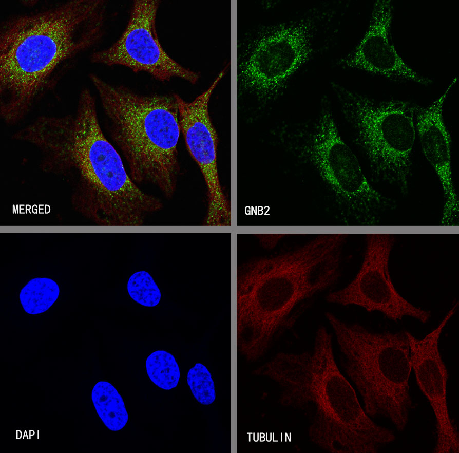 Rabbit anti-GNB2 Recombinant Monoclonal Antibody(S-645-10)
