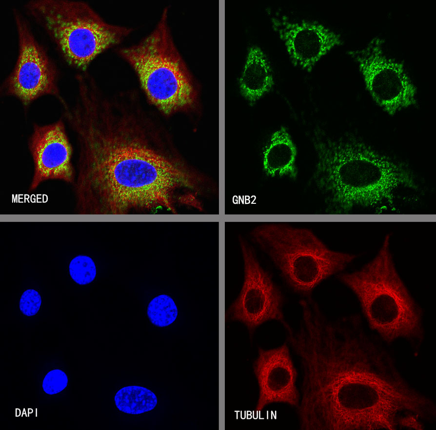 Rabbit anti-GNB2 Recombinant Monoclonal Antibody(S-645-10)