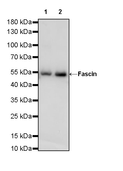 Rabbit anti-Fascin Recombinant Monoclonal Antibody(S-759-13)