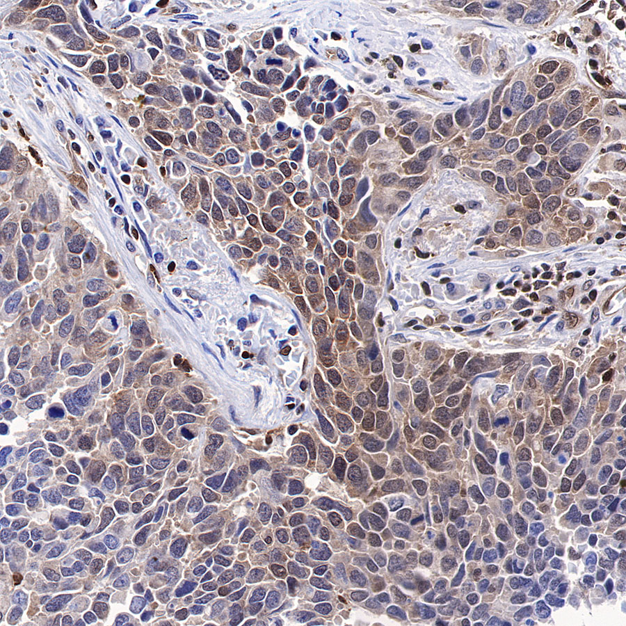 Rabbit anti-MEK3 Recombinant Monoclonal Antibody(S-835-23)