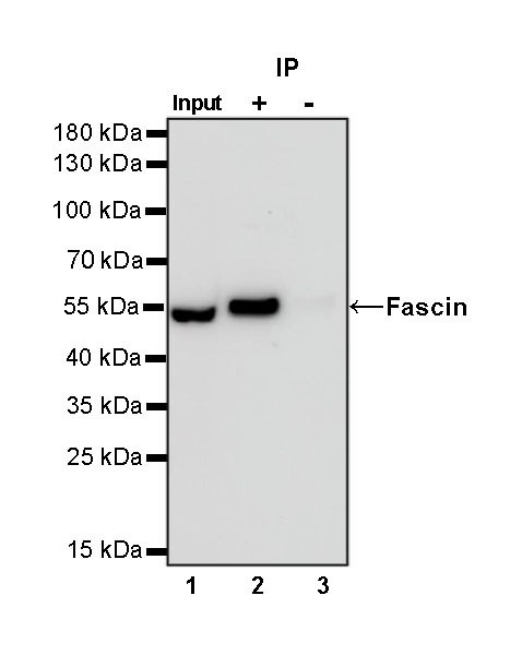 Rabbit anti-Fascin Recombinant Monoclonal Antibody(S-759-13)