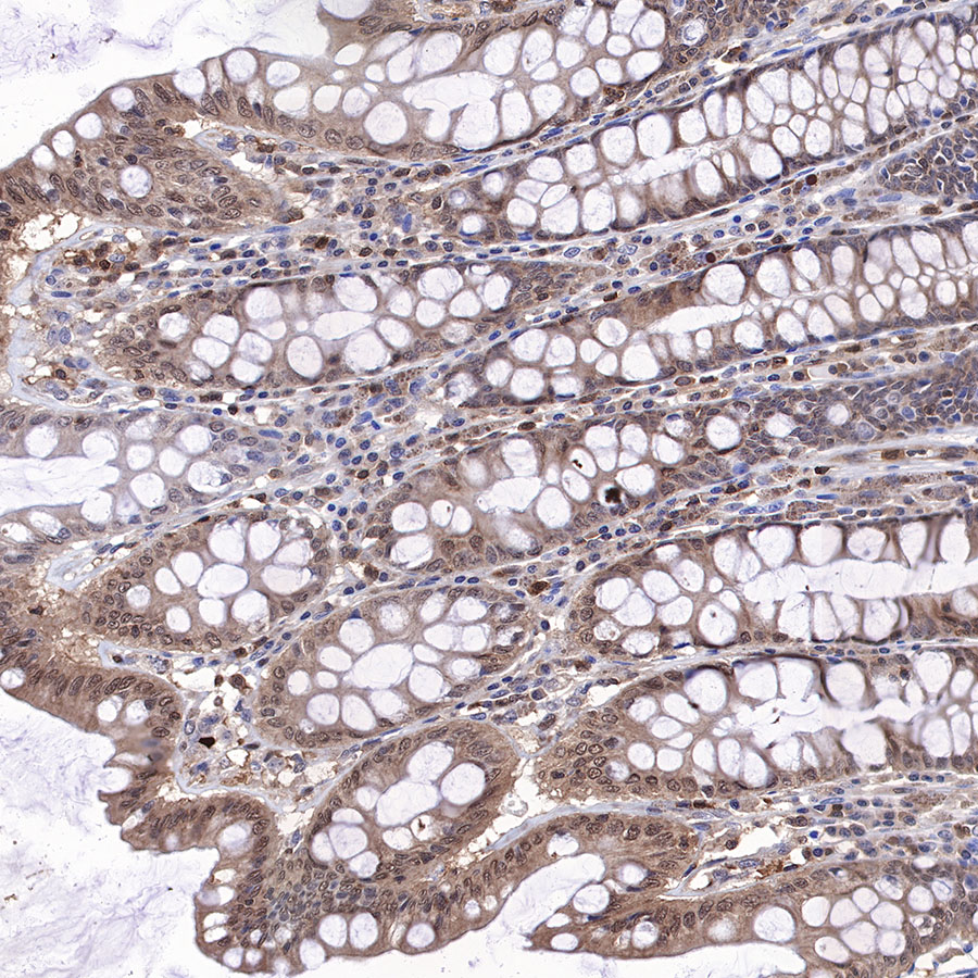 Rabbit anti-MEK3 Recombinant Monoclonal Antibody(S-835-23)