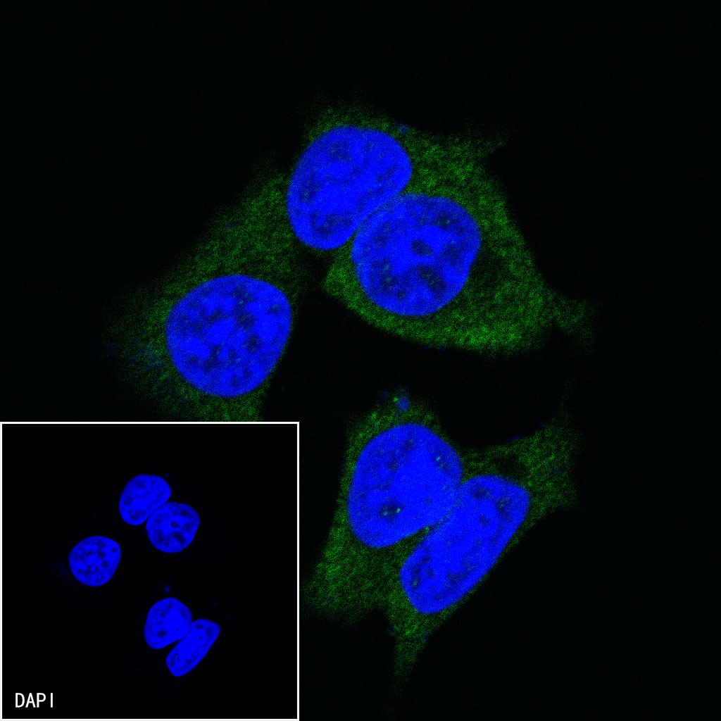 Rabbit anti-TBK1 Recombinant Monoclonal Antibody(S-658-50)