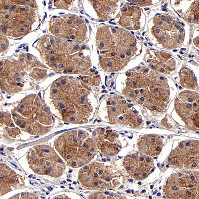 Rabbit anti-TBK1 Recombinant Monoclonal Antibody(S-658-50)