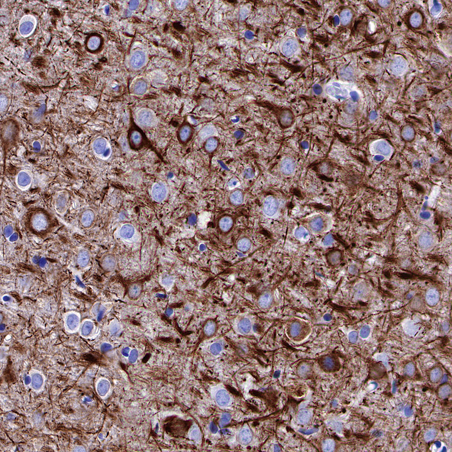 Rabbit anti-Neurofilament H Recombinant Monoclonal Antibody(S-532-103)