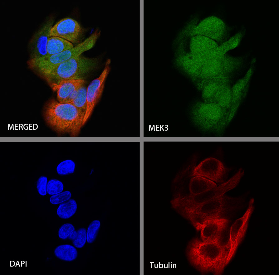 Rabbit anti-MEK3 Recombinant Monoclonal Antibody(S-835-23)