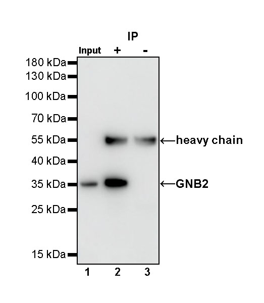 Rabbit anti-GNB2 Recombinant Monoclonal Antibody(S-645-10)