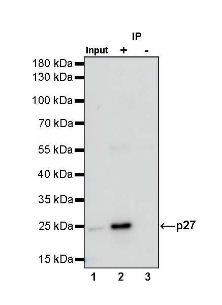 Rabbit anti-p27 Recombinant Monoclonal Antibody(S-141-135)