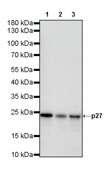 Rabbit anti-p27 Recombinant Monoclonal Antibody(S-141-135)