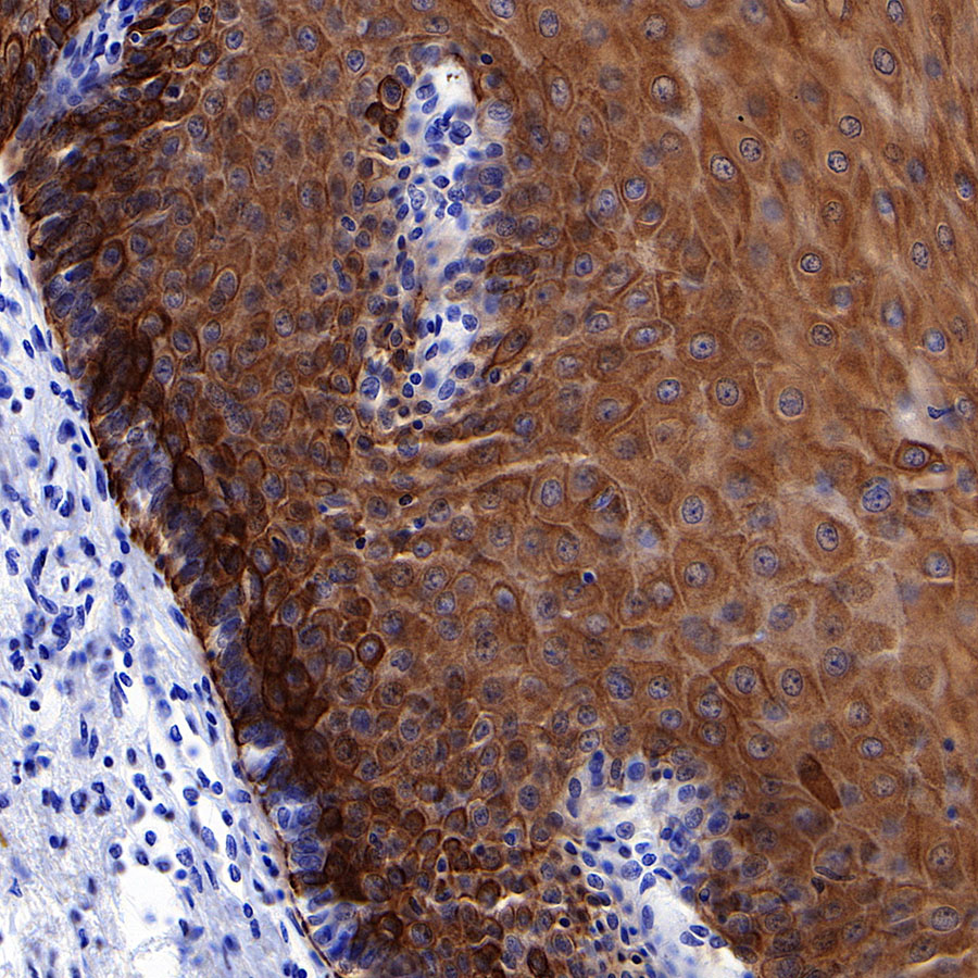 Rabbit anti-Keratin 16 Recombinant Monoclonal Antibody(S-R306)