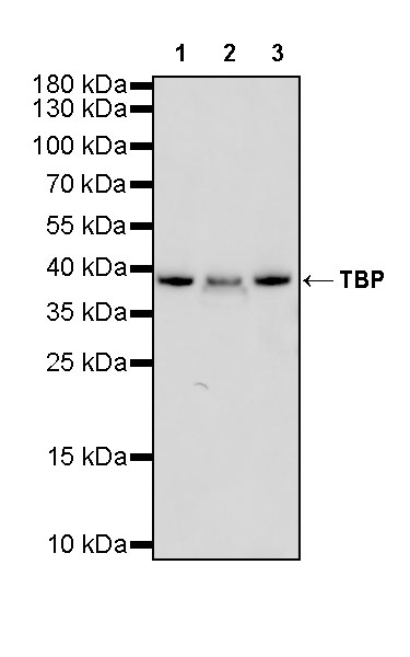 Rabbit anti-TBP Recombinant Monoclonal Antibody(S-886-57)