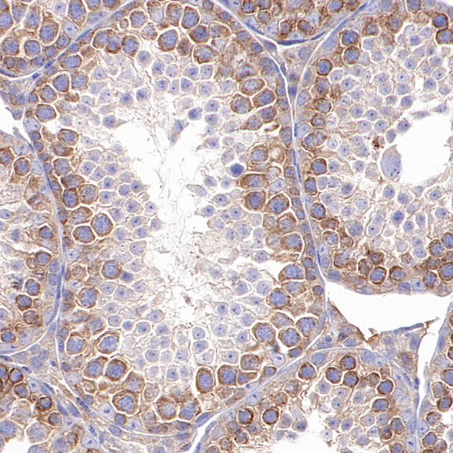 Rabbit anti-TBK1 Recombinant Monoclonal Antibody(S-658-50)