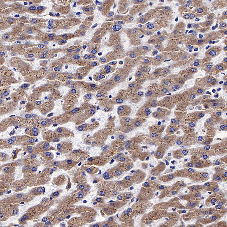 Rabbit anti-Calreticulin Recombinant Monoclonal Antibody(S-R353)