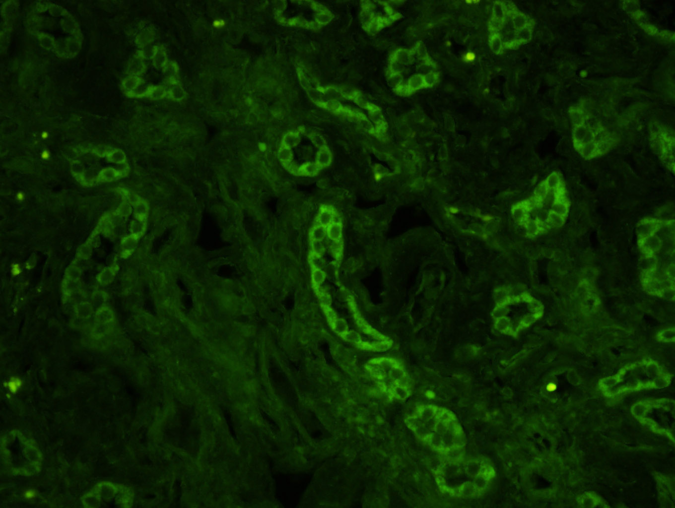 Rabbit anti-Mitofusin 2 Polyclonal Antibody