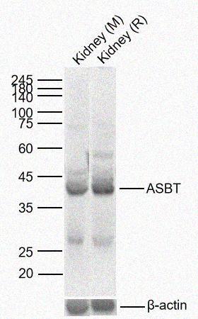 Rabbit anti-ASBT Polyclonal Antibody
