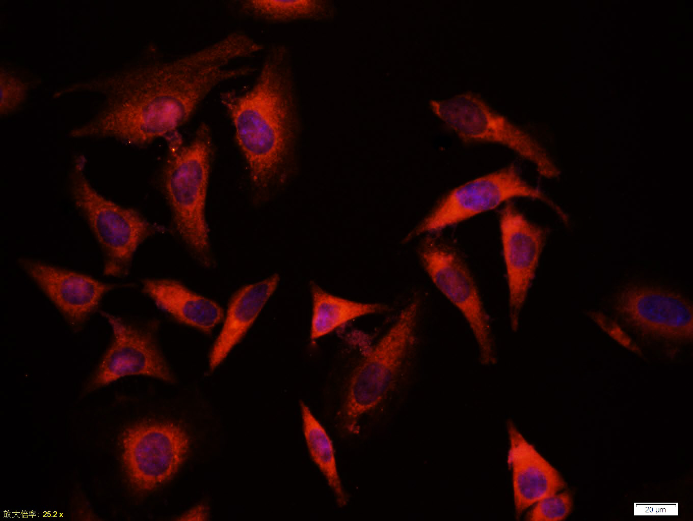Mouse anti-GSK-3β(NT) Polyclonal Antibody