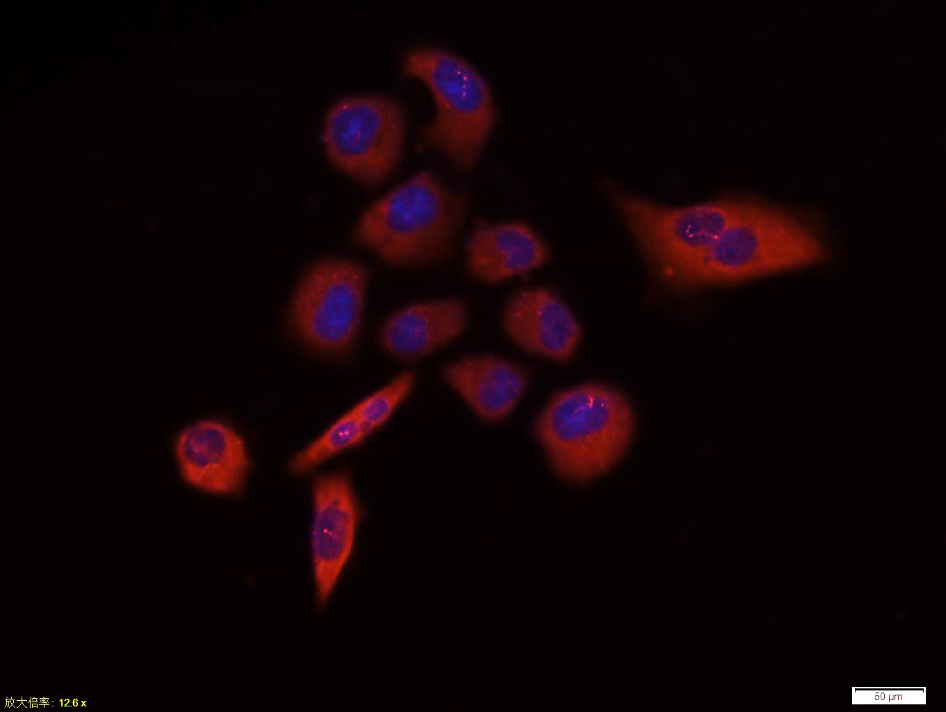 Mouse anti-GSK-3β(NT) Polyclonal Antibody