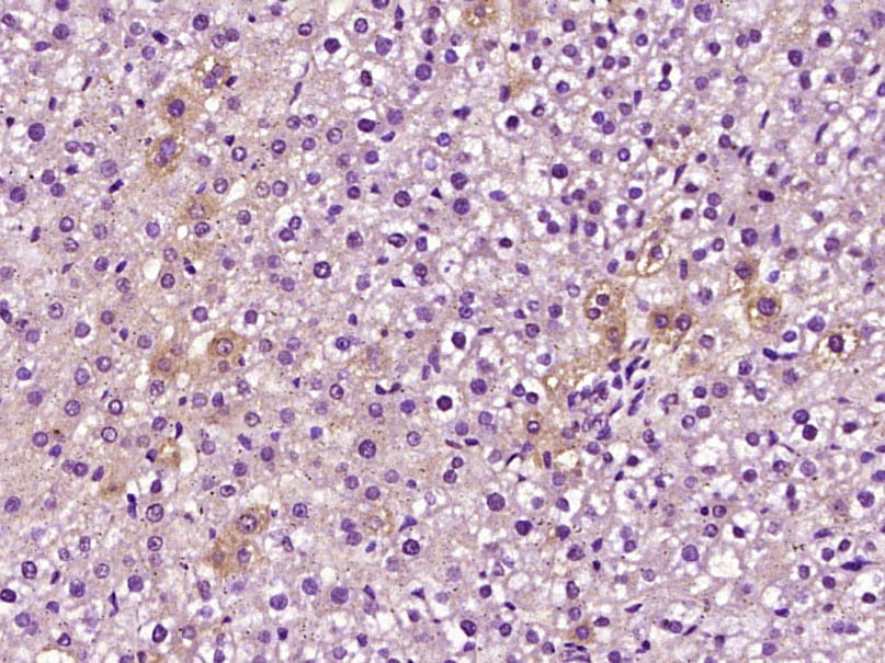 Rabbit anti-C5b-9 Polyclonal Antibody
